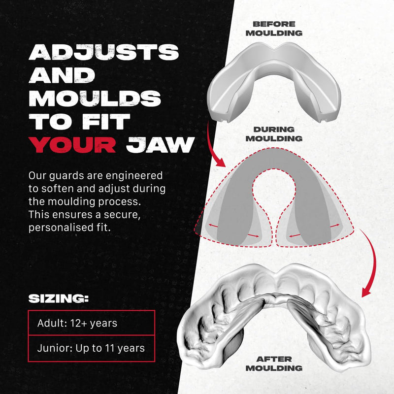 SAFEJAWZ Mouth Guard, Dual Layer Mouthguard for Adults with Case, Easy Fit Remoldable Mouthpiece for Football, Boxing, Lacrosse, MMA, Basketball & All Contact Sports (Adult 12+ Years, Black Fangz) Adults 12+ Years - BeesActive Australia