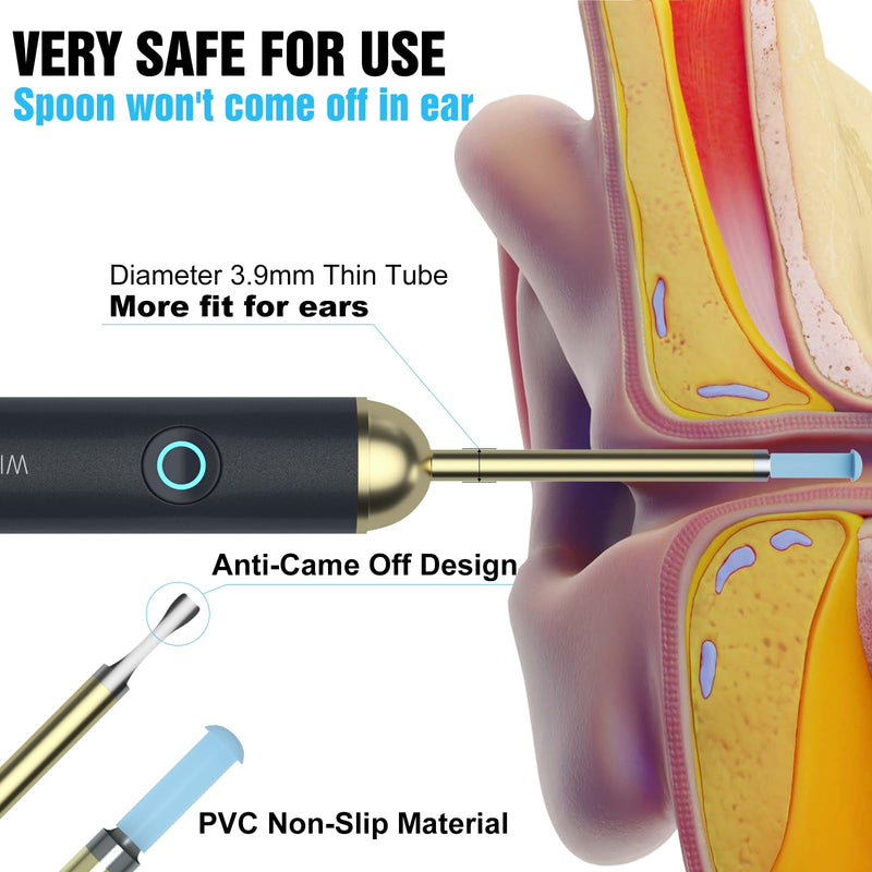 Ear Wax Removal - NIUQICT Ear Cleaner - Ear Camera 1080P with Lights - Ear Wax Removal Tool 9 Pcs - Ear Cleaning Kit, Wireless Otoscope Compatible with Android&iOS for Kids, Adults&Pets Golden Black - BeesActive Australia