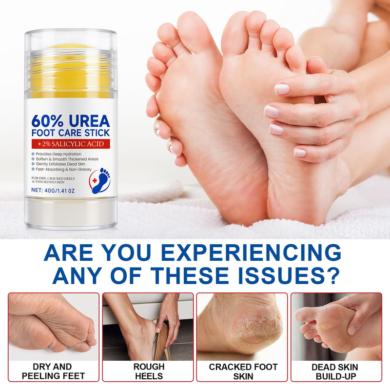 60% Urea with 2% Salicylic Acid Foot Care Stick, Maximum Strength Urea Foot Cream Callus Remover for Dry Cracked Heels, Hands, Knees, Exfoliating Moisturizer, Dead Skin Remover Foot Balm 1.41oz 1.41 Fl Oz (Pack of 1) - BeesActive Australia