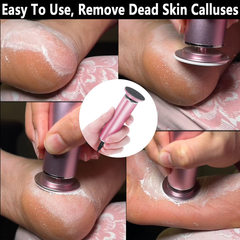 Electric Foot File Callus Remover for Feet, Adjustable Speed Foot Sander Grinder Professional Pedicure Tools for Dead Skin Heel Calluses with Replaceable Sandpaper Discs (Upgraded FCR-1 Pink) - BeesActive Australia