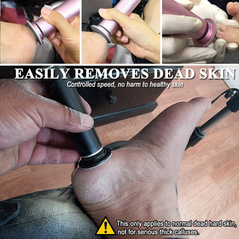 Electric Callus Remover for Feet, Adjustable Various Speed, Powerful Electric Foot File Sander Grinder Pedicure Hard Dead Skin Remover with 60 Sandpaper Discs and Dust Brush, Black FCR-1 04-Black - BeesActive Australia