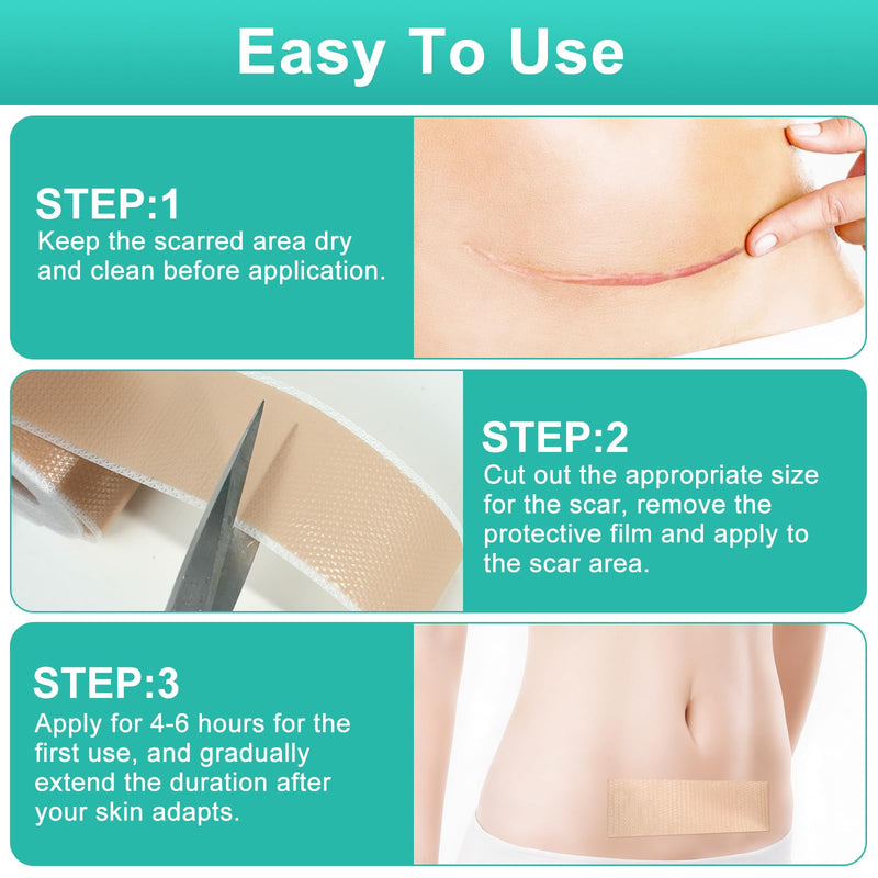 Silicone Scar Sheets(1.6” x 120” Roll-3M), Reusable Silicone Scar Tape for Surgical Scars, C-Section Scars, Stretch Marks, Hypertrophic Scars, Burn Scars, Tummy Tuck and Keloid Scars - BeesActive Australia