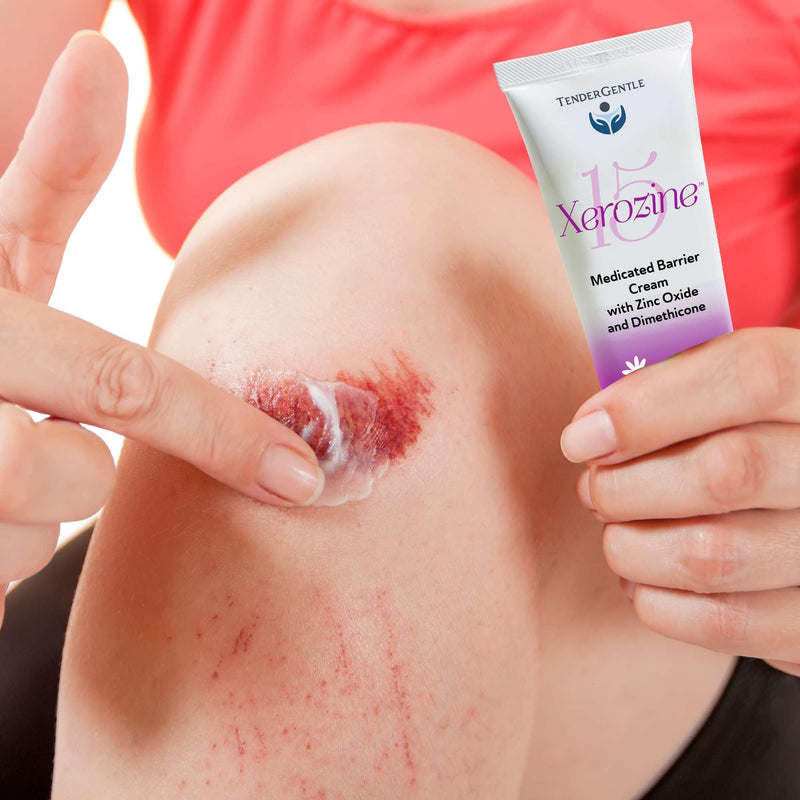Zinc and Dimethicone Cream, 4oz - 4 Pack of Medicated Barrier Rash Cream for Minor Cuts, Scrapes, and Burns - Good for Diaper Rashes 16 Ounce (4 Pack)