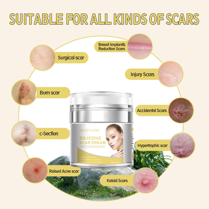 Advanced Scar Cream, Silicone Gel for Scars, Professional Scar Removal Cream for Surgical Scars, Stretch Marks, Old and New Scars, Keloids, Acne, Burns, 2 oz(60ml)