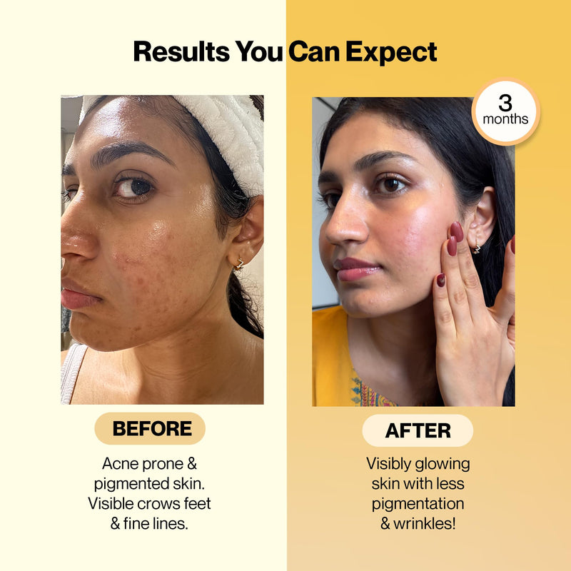 SETU Radiant Skin: Combo Contains 8g Marine Collagen + Ceramosides & 8-in-1 Glutathione Fizzy Tabs | Supports Radiant, Healthy Skin | for Men & Women