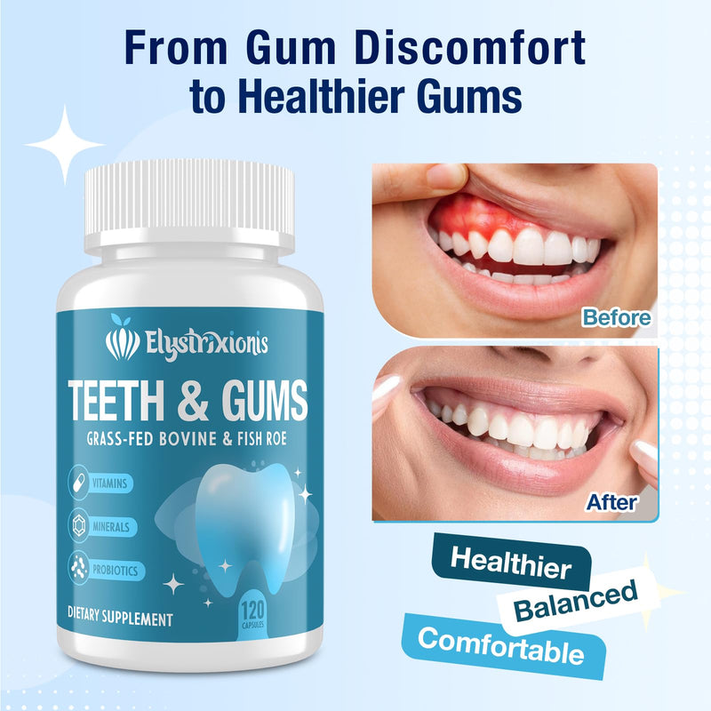 Gum Restore, Gum Repair for Receding Gums – Advanced Formula | 3B CFU Oral Probiotics, Vitamins D3, K2 & C | Supports Tooth Remineralization, Oral Balance & Fresh Breath | 120 Capsules 120 Count (Pack of 1)