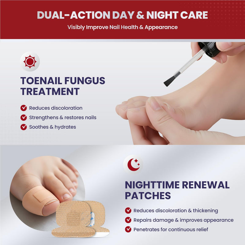 Treatonic Toenail Fungus Treatment Kit: Extra Strength Antifungal Nail Repair Solution with 25% Undecylenic Acid (30 mL) & 32 Nighttime Renewal Patches - Repairs Damaged & Restores Discolored Nails 2 Bottles + 32 Patches