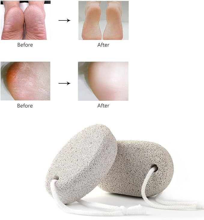 Phogary 2 Piece Natural Pumice Stone for Feet Lava Rock Pedicure Tool for Feet and Hands Hard Skin Exfoliating - Natural Foot File Exfoliating Remove Dead Skin - BeesActive Australia