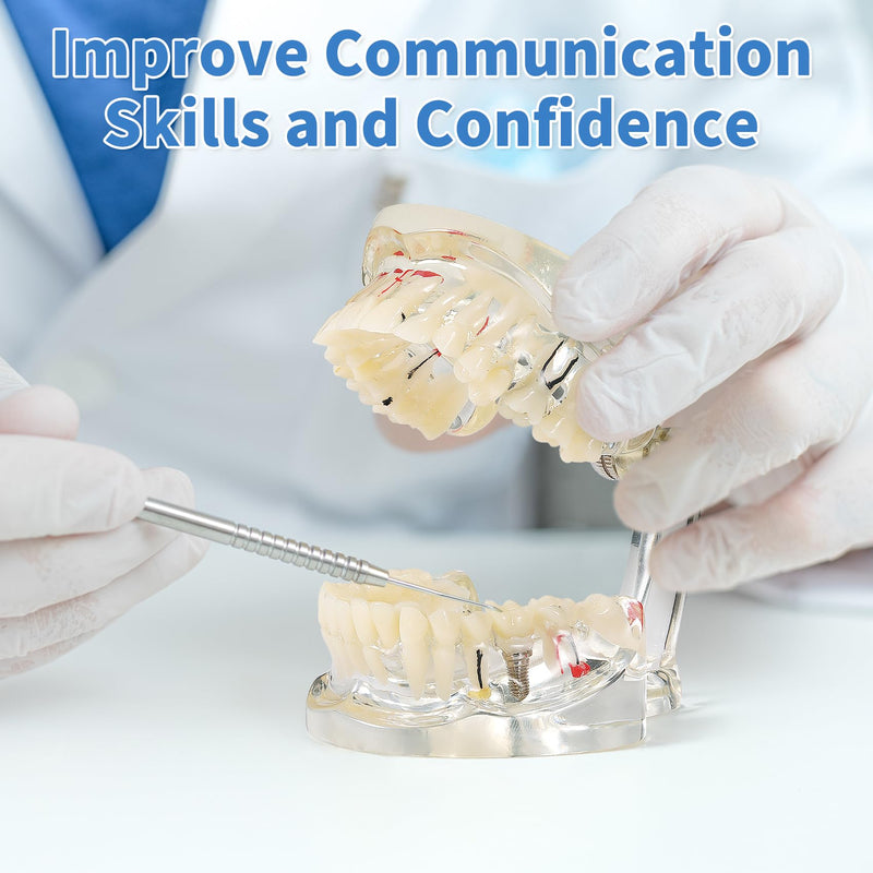 Annhua Transparent Disease Teeth Model for Dental Students, 32 Standard Removable Typodont Teeth Pathological Teaching Model - Ideal for Teaching, Not for Clinical Use Standard-Transparent Teeth Model - BeesActive Australia