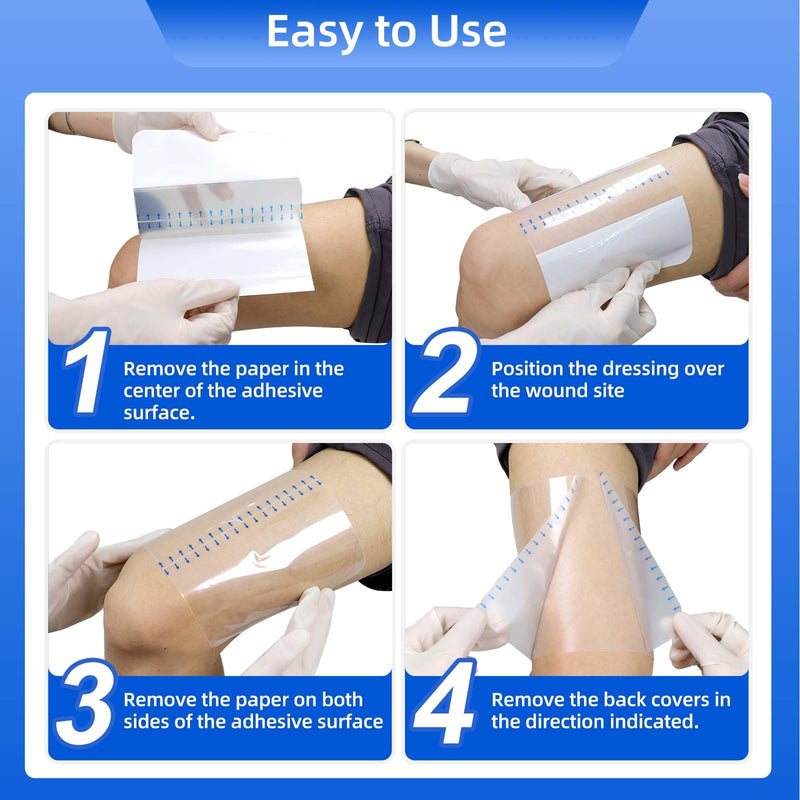 Niceful Transparent Film Dressing 30 Count-Clear Bandages for Wounds 6" x 8", Waterproof Adhesive Wound Cover Bandages for Post Surgical Shower or IV Shield, Scar Therapy, Tattoo Dressings 6 x 8 in - BeesActive Australia