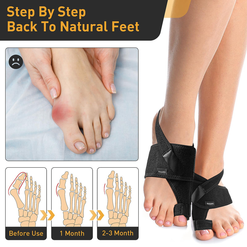 4PCS Bunion Corrector for Women & Men, 2PCS Big Toe Straightener with Splint & Pads（2-4hours,) 2PCS Big Toe Separator with Silicone Padding (24hours), bunion relief Reduce Pain, Washable(Black) R/L