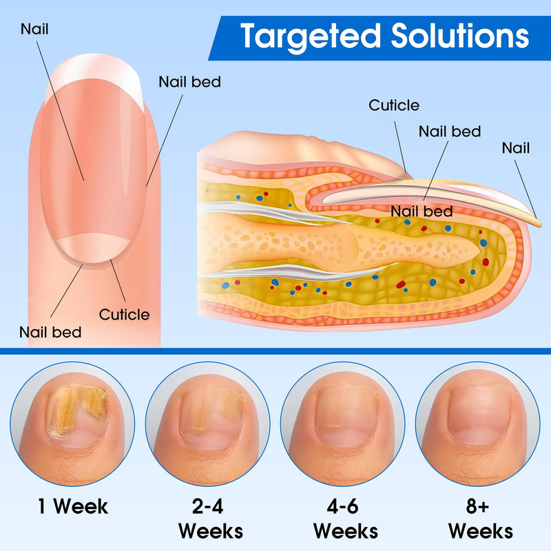 EASICUTI Fungal Nail Patches, 60 PCS Toenail Treatment Extra Strength, Overnight Nail Repair Sticks for Damaged Nails, Men and Women
