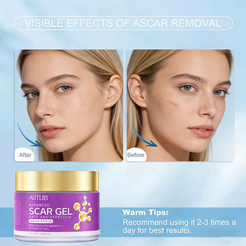 Scar Cream,Silicone Scar Gel,Helps Reduce Surgical Scars,Acne,Burn,Keloids Bump,Stretch Marks, Advanced Scar Removal Cream for Old and New Scars (1.59oz) 1.59 Ounce - BeesActive Australia