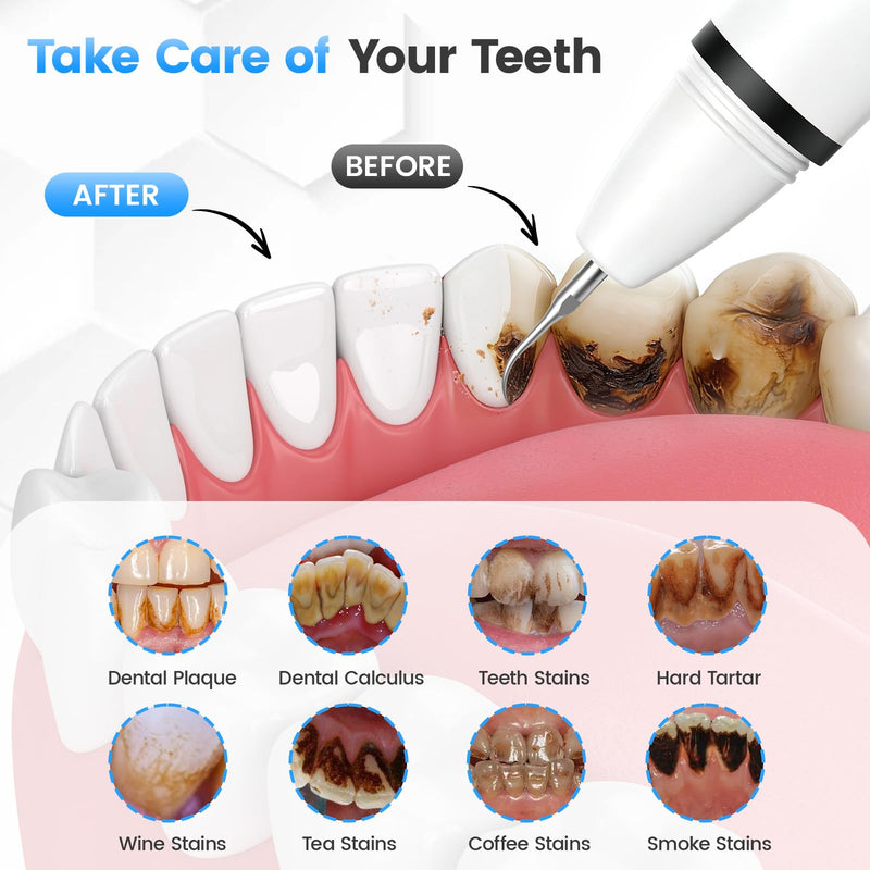 Plaque Remover for Teeth, Tartar Remover with 4 Tips