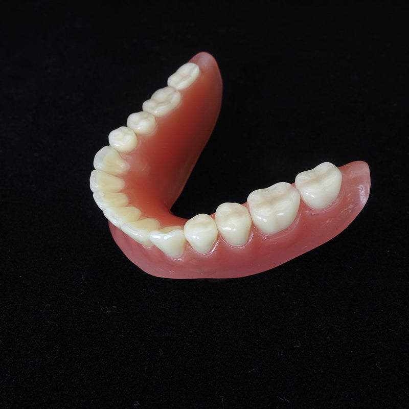 Dental Model Overdenture Inferior 2 Implants Demo for Studing and Teaching