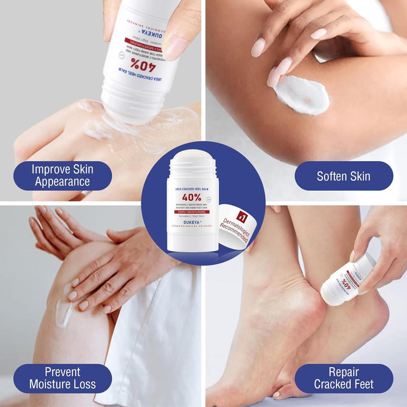 OUKEYA Urea Cream Stick 40% – for Dry, Cracked Heels & Rough Skin on Feet and Hands, 40 Percent Urea Lotion for Feet Maximum Strength,1.06 oz (2 Pack) 1.06 Ounce (Pack of 2)