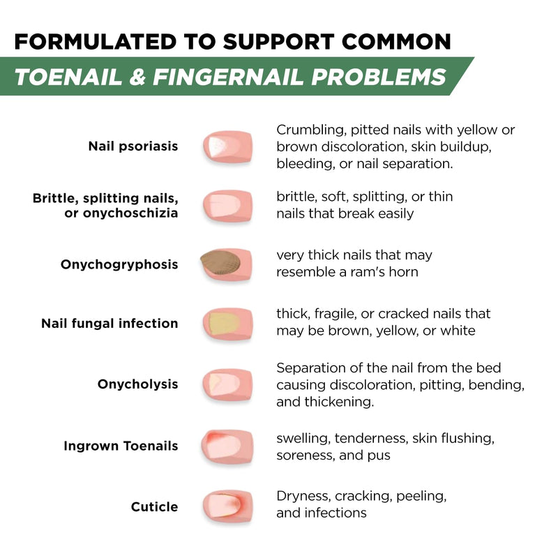 Foot Cure Toenail Fungus Treatment Extra Strength – Athletes Foot Treatment for Toenails, Restorative Nail Repair for Damaged Nails, Toenail Softener with Tea Tree Oil & Oregano Oil - Made in USA 0.5 Fl Oz (Pack of 1)