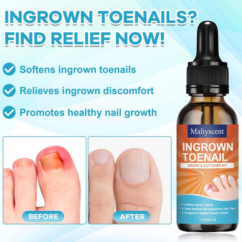 Ingrown Toenail Drop - Ingrown Toenail Pain Reliever and Softener Kit for Men Women Ingrown Toenail Corrector Drops