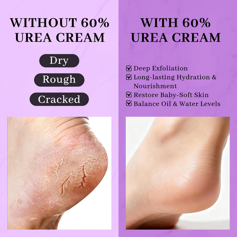 5-in-1 60% Urea Cream with 2% Salicylic Acid, Urea Cream 60 Percent for Feet & Hands- Maximum Strength Moisturizer for Rough, Dry, Thick & Cracked Skin, Callus Remover, Deep Hydration, 150g - BeesActive Australia