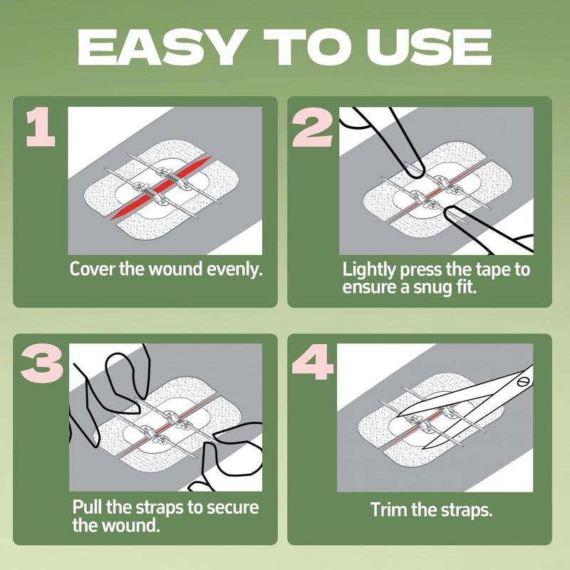 10Ct Sterile Butterfly Wound Closure Strips Bulk Pack W10