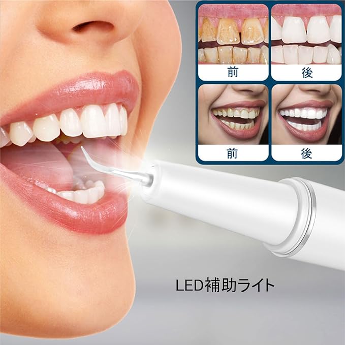 UJHOSLD Ultrasonic Tooth Cleaner, Oral Cleaner, USB Rechargeable, Ultrasonic Vibration, Portable Teeth Cleaner, 5 Modes Adjustable, Built-in LED Lighting, Cleaning Kit, IPX6 Waterproof, Portable and - BeesActive Australia