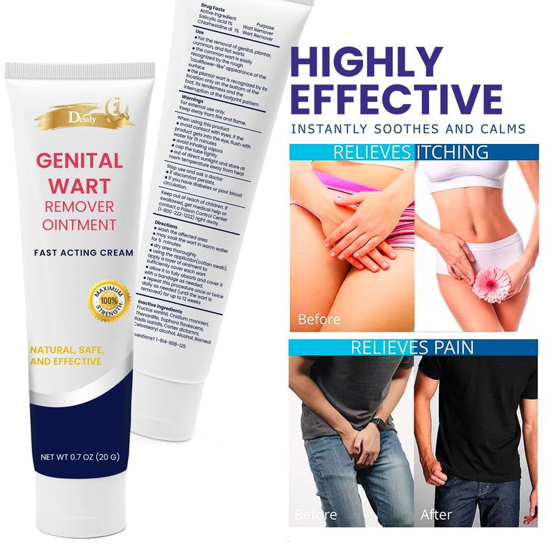 Fast Action Cream Wart Gel Maximum Strength - Wart Ointment with Salicylic Acid - Fast-Acting Wart Freeze Off - Wart Cream for Genital Warts, Warts, Plantar Wart, Common Wart, Corn, Flat Wart - BeesActive Australia