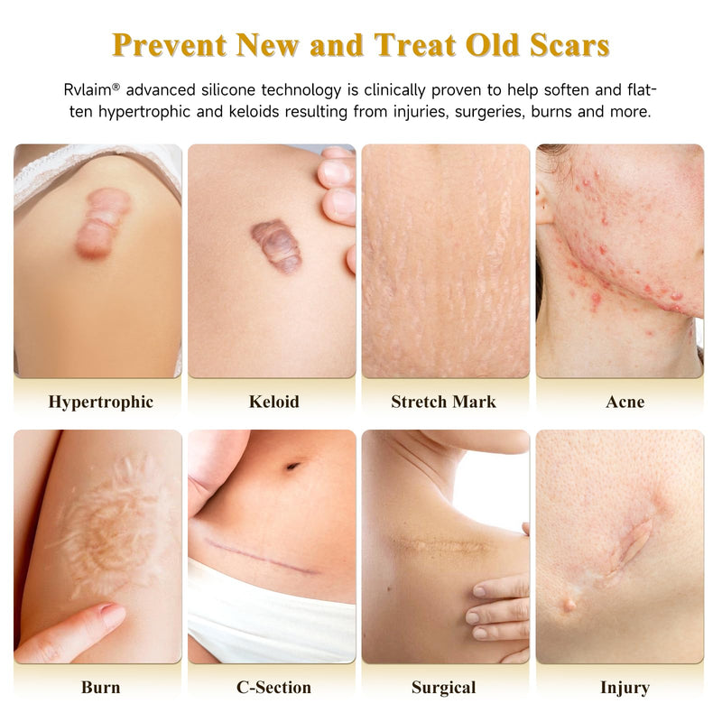 Scar Cream Silicone Scar Gel, Scar Cream for Surgical Scars, Advanced Scar Removal Cream for C-Section, Injury, Acne, Burns, Keloids, Stretch Marks, Old & New Scars, 1.85 Oz (55g) 1.85 Fl Oz - BeesActive Australia