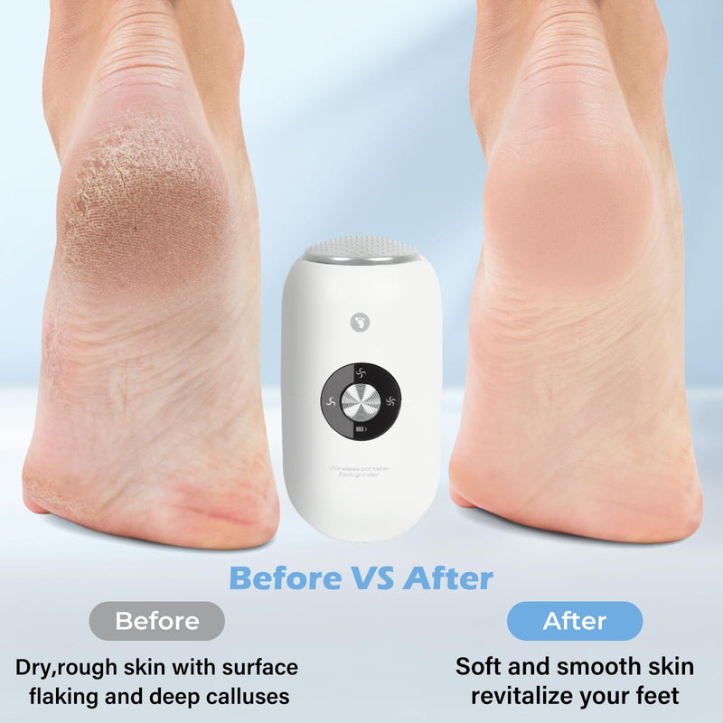 Electric Foot Callus Remover Grinder - Rechargeable Pedicure Tools Callus Remover for Feet Foot Scrubber File Foot Care with 3 Speeds 2 Stainless Grinding Heads for Hard Cracked Dry Dead Skin - BeesActive Australia