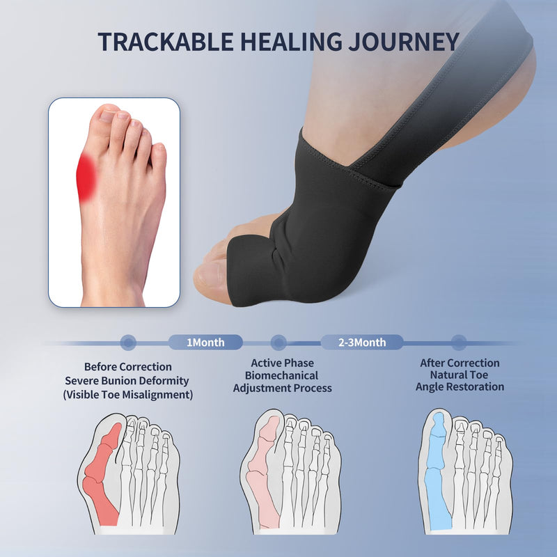 2PCS Bunion Corrector for Women & Men Big Toe, Bunion Relief Toe Straightener Bunion Splint Anti-Slip Heel Strap Comfortable Breathable for Day and Night Wear Black XL X-Large - BeesActive Australia