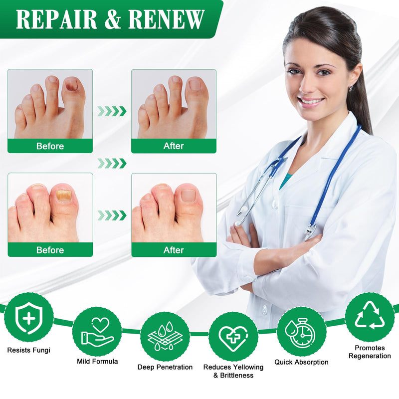 Toe Nail Fungus Renewal Pen, Toenail Fungus Renewal, 3 Packs Powerful Fast Acting For Thick, Discolored, Broken & Damaged Toe & Finger Nail 0.4 Fl Oz (Pack of 1)