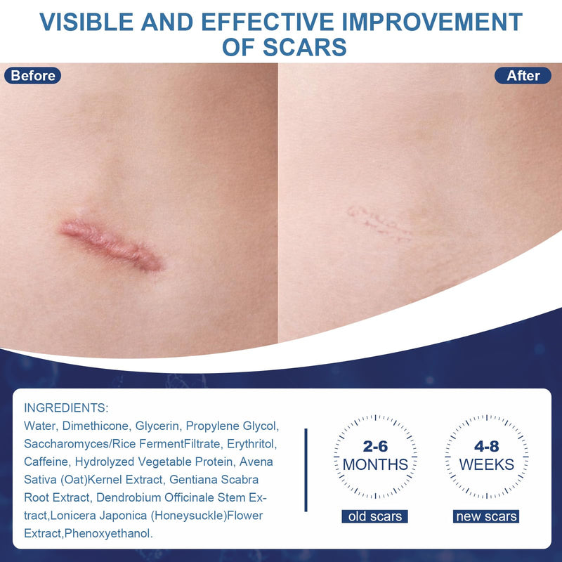 Scar Cream,Silicone Scar Gel,Helps Reduce Surgical Scars,Acne,Burn,Keloids Bump,Stretch Marks, Advanced Scar Removal Cream for Old and New Scars (1.59oz) 1.59 Ounce - BeesActive Australia
