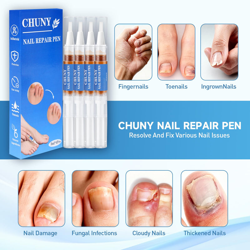 Extra Strength Nail Repair Pen, 4 Nail Oil Cuticle Pens With Natural Plant Extracts for Repairing Discolored, Broken & Damaged Toenails, Effective Nail Repair Solution - BeesActive Australia