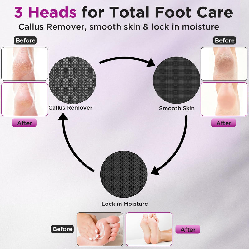 Electric Foot Callus Remover, Apply Oil,Foot SPA, Foot File,Reusable Nano-Glass Head, Ergonomic Premium Aluminum Callus Remover for feet, Rechargeable Pedicure Tools for Feet,Gifts for Men Women sliver - BeesActive Australia