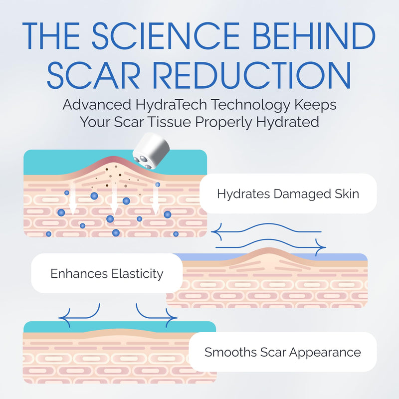 Silicone Scar Gel with Scar-Smoothing Tri-Roller Tip – Designed for Scar Massage – Medical-Grade Silicone for Surgical, C-Section & Acne Scars – Fragrance-Free & Hypoallergenic Roller Applicator
