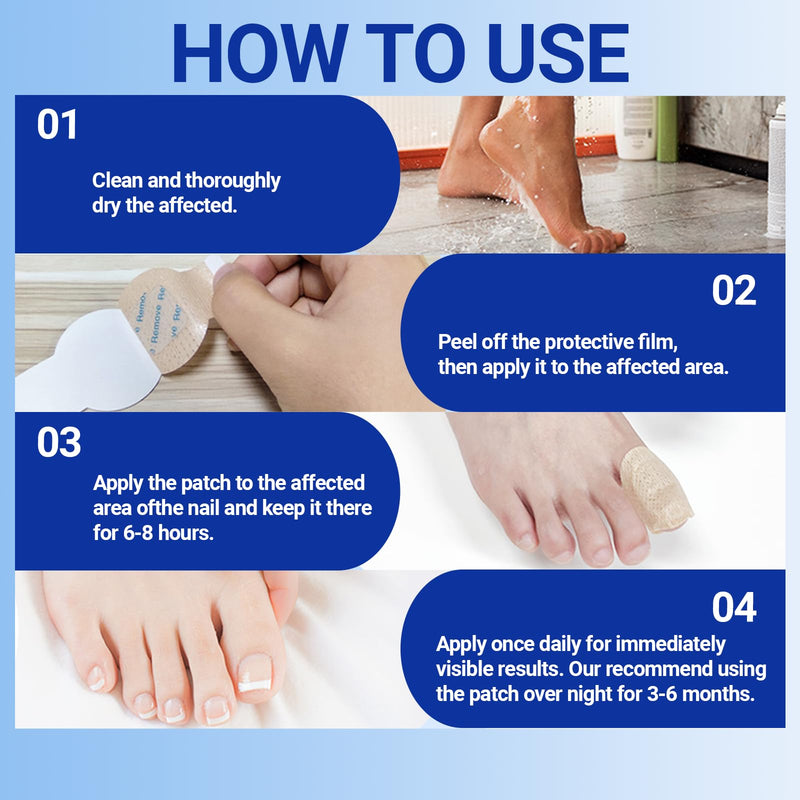 Toenail Fungus Treatment Extra Strength - 21 Pcs Fungal Nail Patches, Foot Nails Repair & Strengthen Patches for Women & Men (1 Count (Pack of 21)) 1.76 Ounce (Pack of 1) - BeesActive Australia