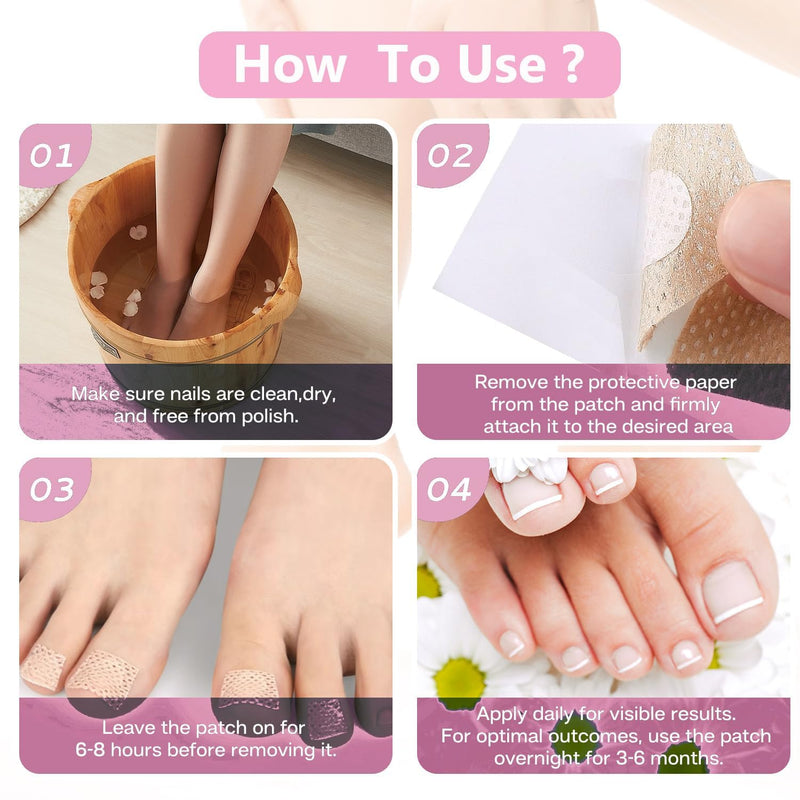 Fungal Nail Patches 60 Pcs – Extra Strength Hydrogel Treatment for Toenail Fungus, Upgraded Overnight Repair Nail Patches, 8-Hour Nighttime Nail Fungus Patches for Nail Fungus Treatment - BeesActive Australia