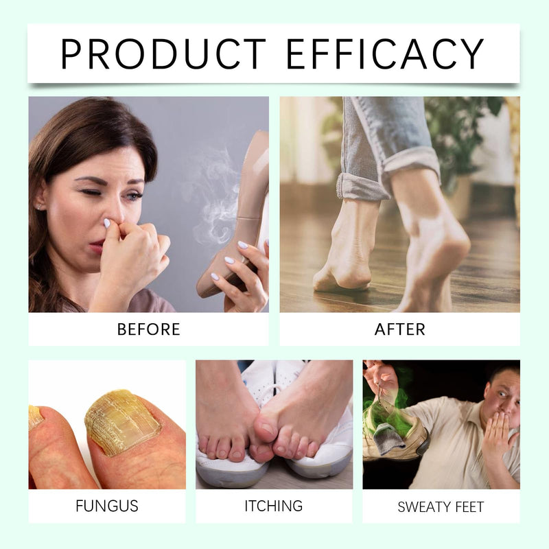 Foot Sanitizer Spray with Tea Tree Oil, Tea Tree Oil Feet Spray, Clear Foot Sanitizer Spray (2PCS) 2pcs - BeesActive Australia