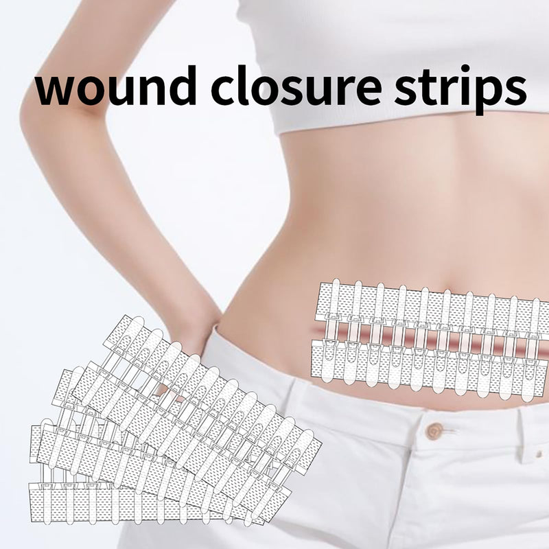 Wound Closure Strips Zip Stitch Sutures Butterfly Bandaids Emergency Laceration Closure Kit for Lacerations Incisions Cuts(6X8CM) 6x8cm