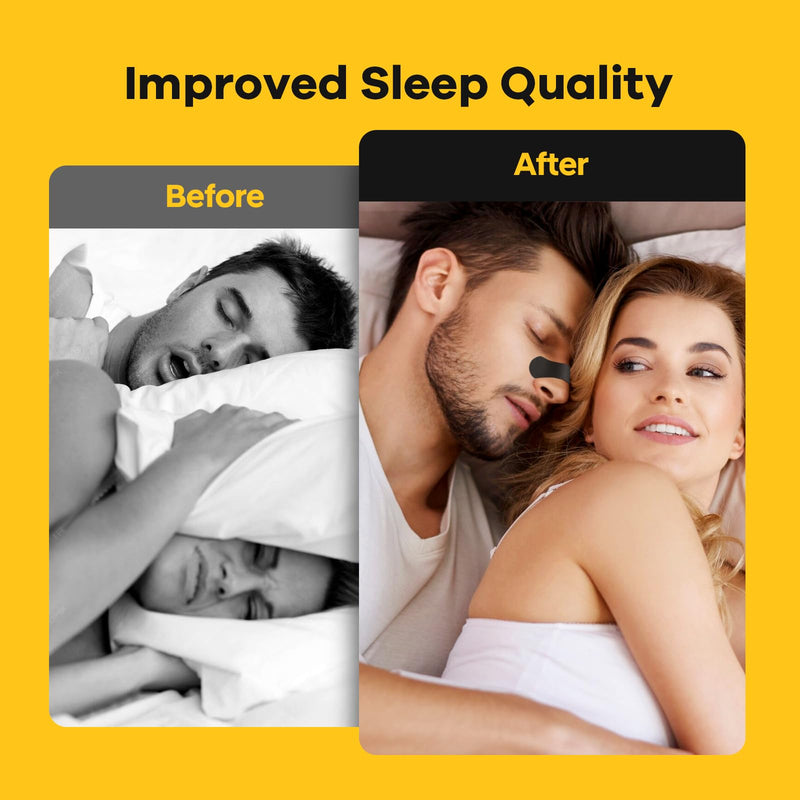 Nasal Strips (36 Strips), Nasal Strips for Breathing, Nasal Strips for Sensitive Skin, Congestion Relief Caused by Colds & Allergies, Universal Fit, Extra Strength, Black