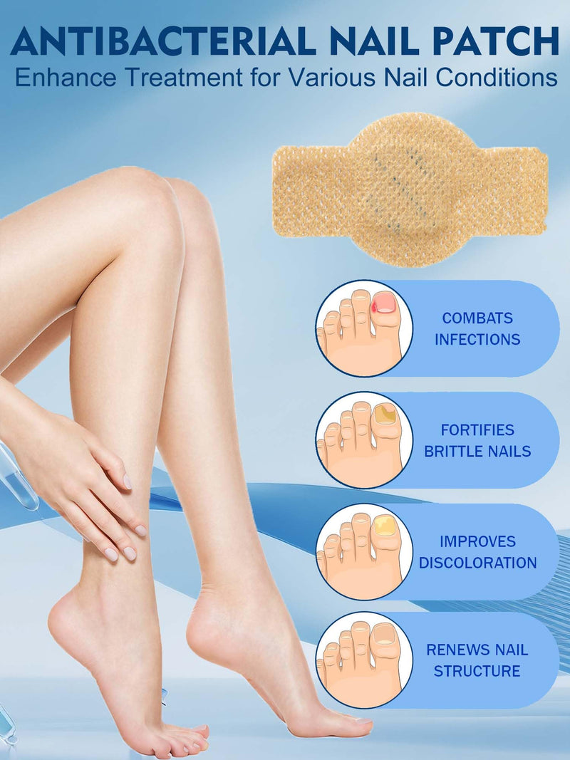 Nail Patches Toenail Treatment Extra Strength 8-Hour Overnight Nail Fast Acting Repair Effortless Hydrogel Nail Care and Repair for Damaged Nails Overnight Renewal for Men and Women (24, Medium)