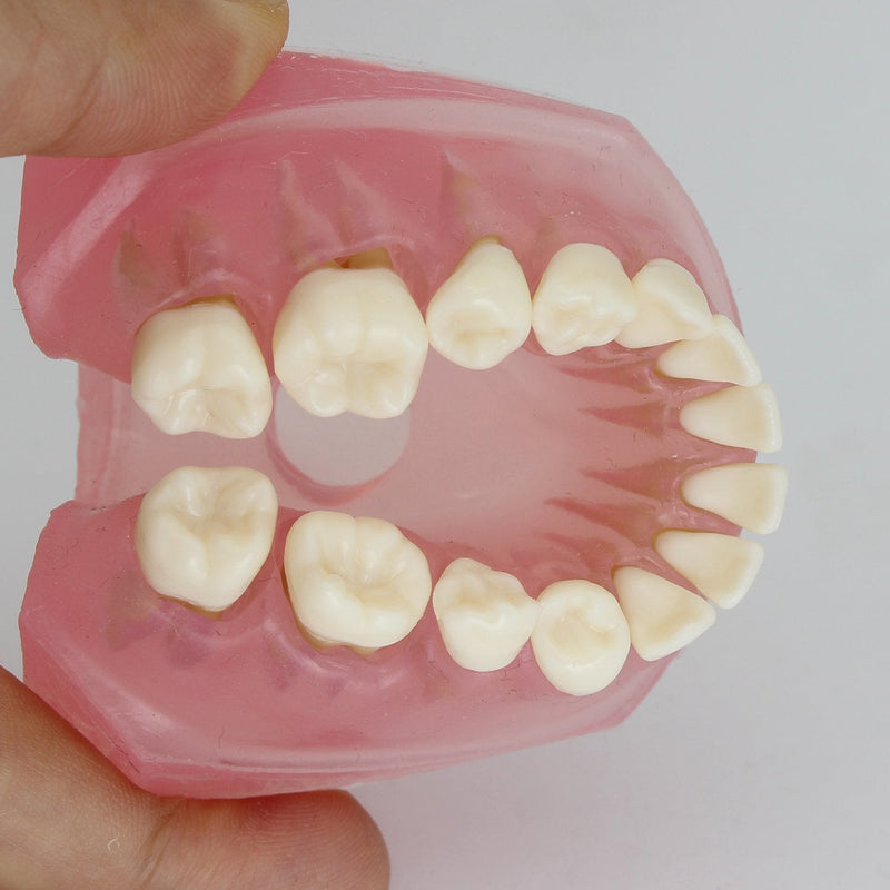 Dental Implant Teeth Model with Removable Teeth for Dental Professionals and Students - BeesActive Australia