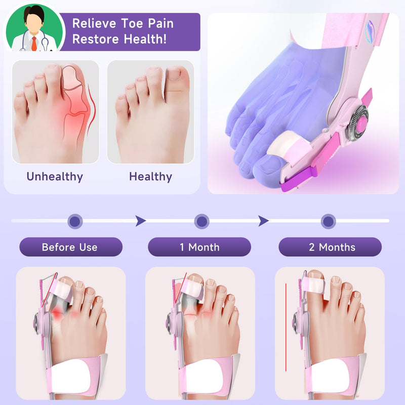Bunion Corrector for Women & Men - Bunion Fix for Hallux Valgus Pain Relief with Non-Slip Big Toe Separator, Adjustable Big Toe Straighter, Bunion Splints Fits Left & Right Feet (Pink 2Pcs)