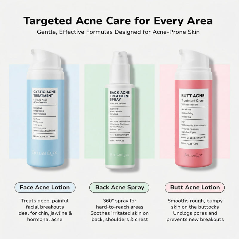 BellamiLuxx Fungal Acne Treatment Lotion: Effective Face & Body Pimple Cream for Bumps, Clusters, Itch & Redness – Fungal Prone Skin Acne Treatment Moisturizer for Teens & Adults with Natural Actives 1-Bottle - BeesActive Australia