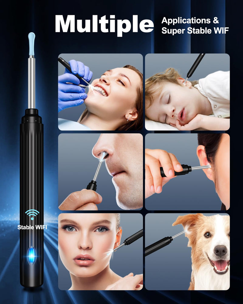 Ear Wax Removal Kit,Ear Cleaner with Camera,Ear Cleaning Kit 1269P HD Otoscope with Lights and 6 Ear Picks, Earwax Removal for Adults and Children Black - BeesActive Australia