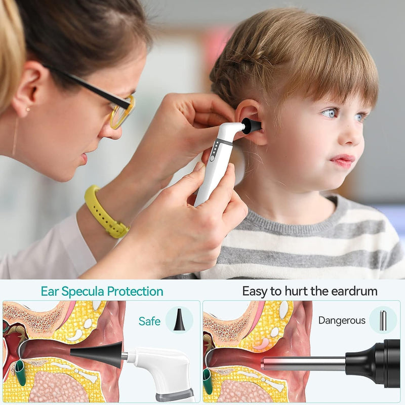 Ear Specula Set for ScopeAround Digital Otoscope, Set of 50 Pieces, Replacement Otoscope Tips, Ear Speculum, Compatible with ScopeAround SA39W/SA39i/M28/MS450 Otoscope - BeesActive Australia