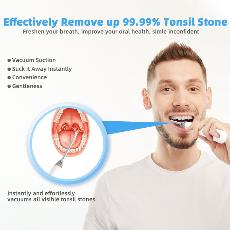 Voraiya Electronic Tonsil Stone Remover Vacuum, 5 Modes Instant Suction Cleaner Tool, 10 in 1 Tonsil Stone Removal Kit, Easy to Use, Fight Bad Breath White - BeesActive Australia
