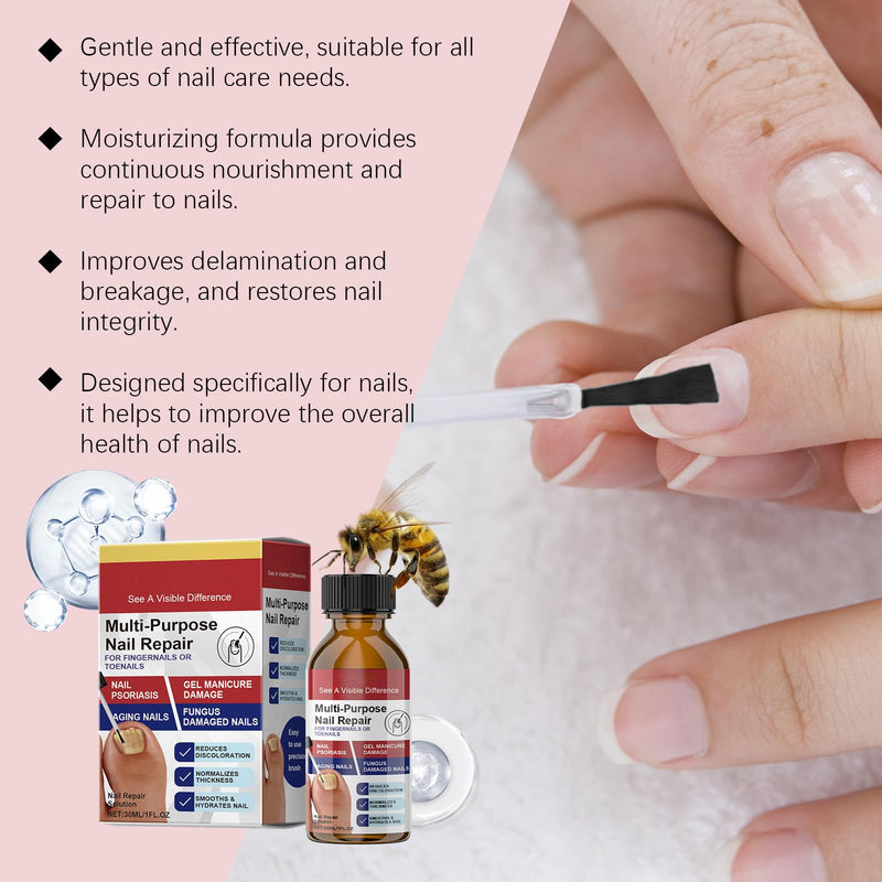 Toenail Fungus Patches 21 Pcs + Liquid Solution 1 Fl Oz 8-Hour Overnight Repair safely and gently Treatment Toenail,Fast Acting Hydrogel Nail Care-Strengthens & Improves Discoloration and Thickness Red - BeesActive Australia