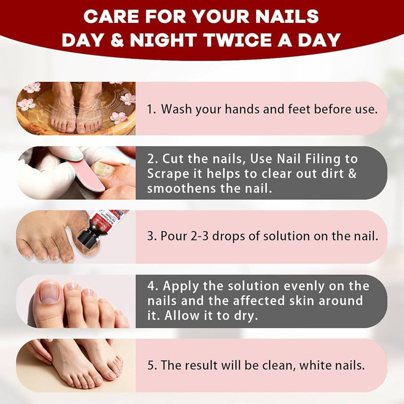 Toenail Fungus Treatment - Fast Acting For Thick, Discolored, Broken & Damaged Toe & Finger Nail, Treats Damaged Nails and Ingrown Toenails - 30ml/1oz (1pcs) 1pcs