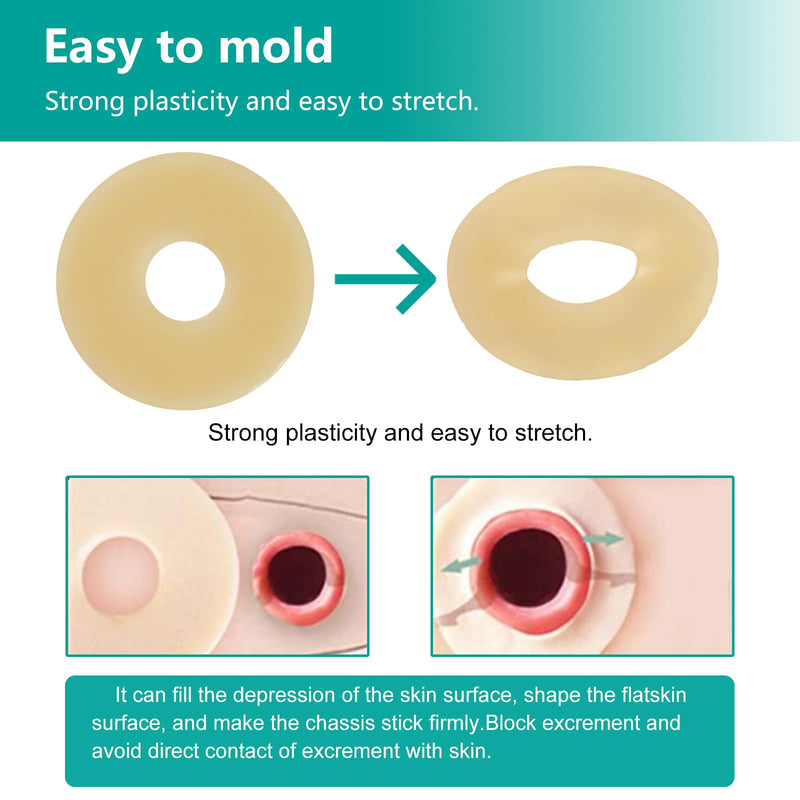 Ostomy Barrier Rings - Outer Diameter 2" (50mm) 2mm Thickness,Moldable Ostomy Rings,Hydrocolloid Skin Extender Rings for Colostomy Bags,10 Count 10PCS Ostomy Barrier Rings