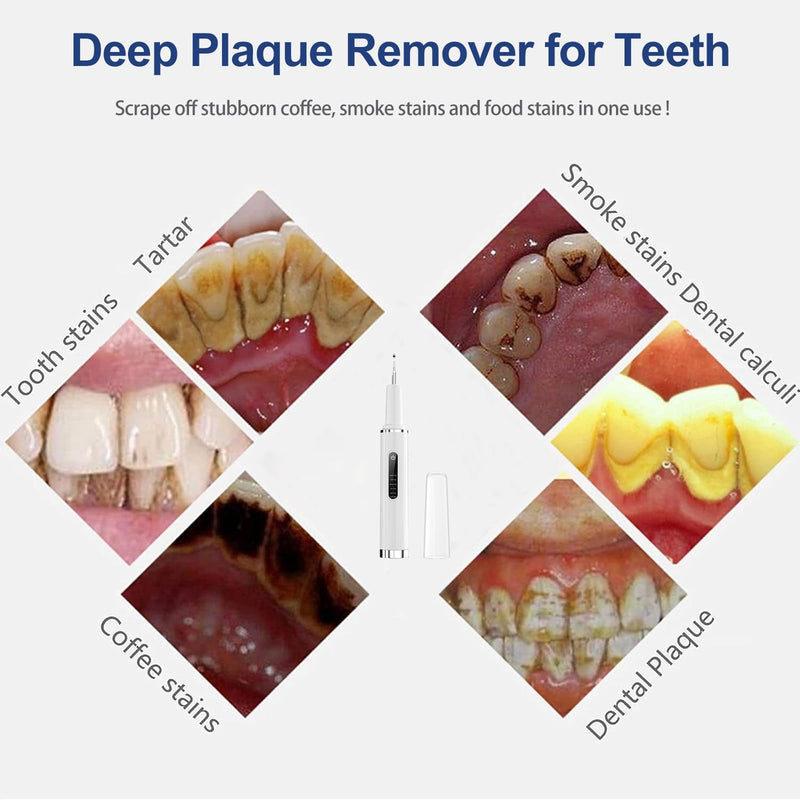 Professional Plaque Remover for Teeth, Teeth Cleaner Tool with Intelligent and Secure Sensor Technology, 4 Replaceable Heads 5 Modes, OLED Light & Oral Mirror, Rechargeable Teeth Cleaning Kit For Home - BeesActive Australia